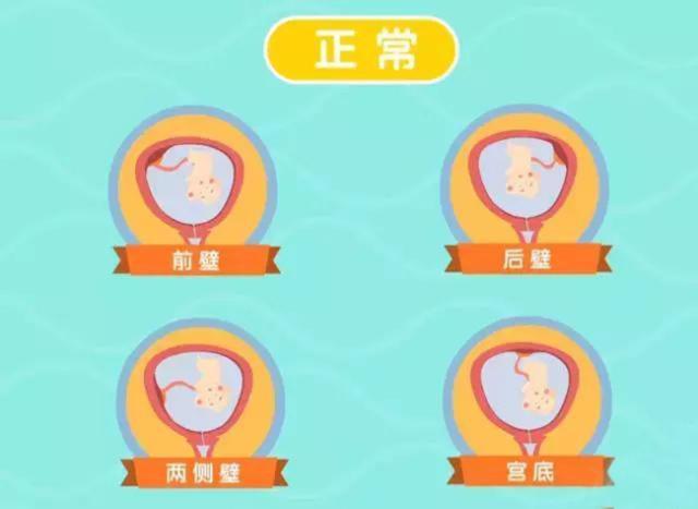 12周b超胎盘位于子宫前壁0级,16周b超显示胎盘成熟0级