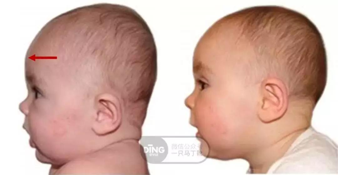 修饰扁头头型的发型,头型不好扁头适合什么发型