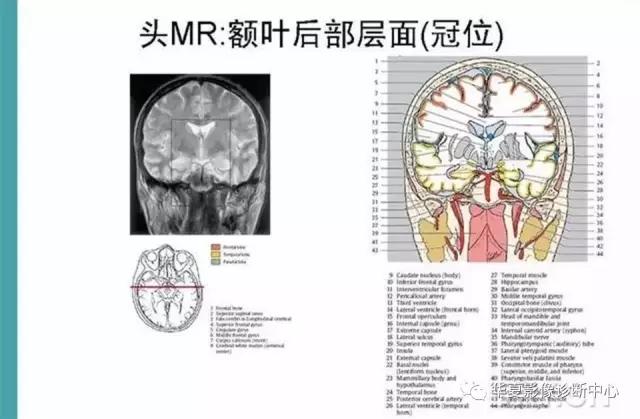 mra头颅解剖学详细讲解视频,常见的头颅mri图像