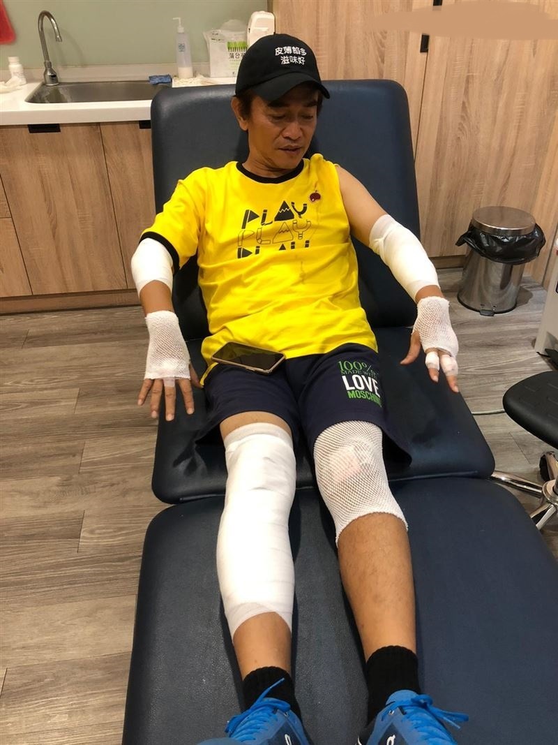 吴宗宪摔车完整视频,吴宗宪意外摔车视频