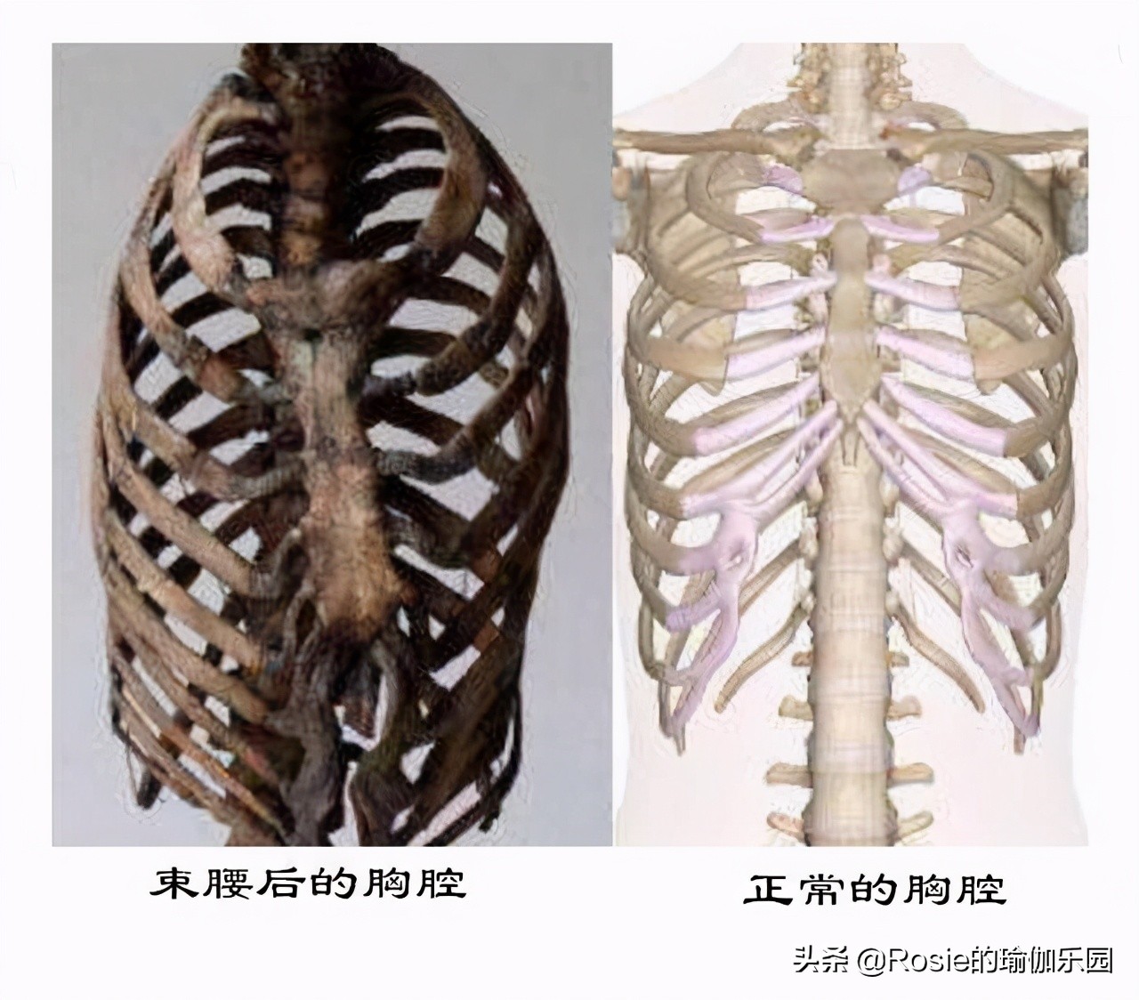 眼馋陈卓璇巴掌腰,竟靠束腰勒小腰?做对一个动作一周瘦出小蛮腰