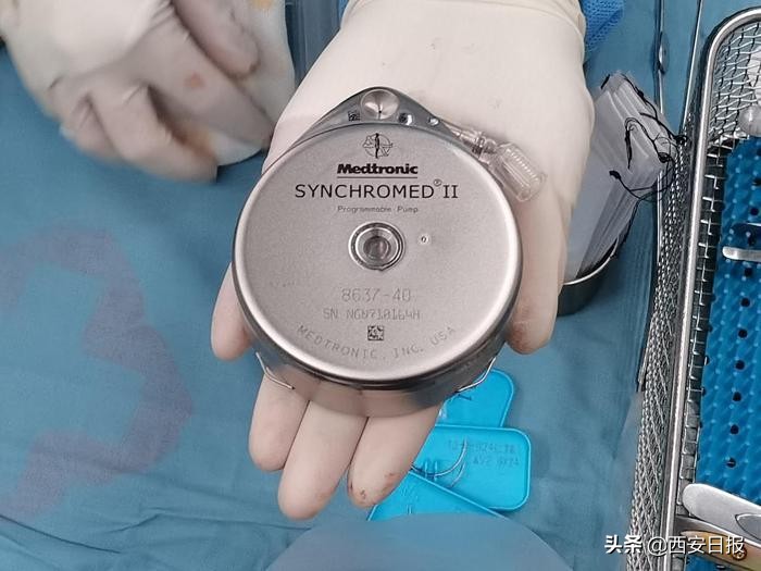 一泵“镇”顽痛!交大一附院鞘内药物输注泵植入术迈进止痛“高速公路”
