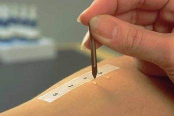 孩子总是过敏应该看什么科,孩子经常过敏如何找出元凶