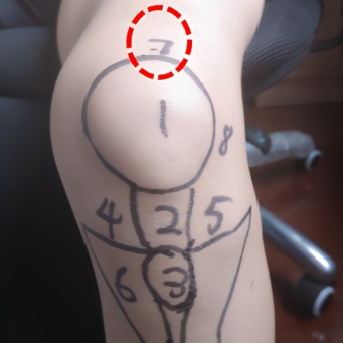 不同部位膝关节,骨科医生教你一招搞定膝盖痛