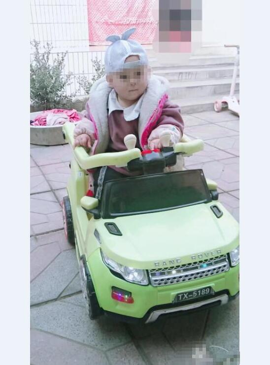 如果宝宝遗传了鱼鳞病多久会发现,鱼鳞病怎么不遗传给宝宝