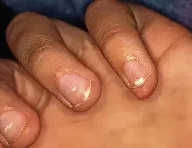 如何不做美甲就能让指甲变得精致,美甲教学指甲的简单基础护理