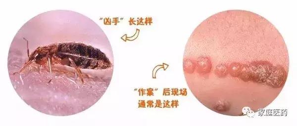 染发皮肤过敏应该用什么药物治疗,皮肤过敏对症下药