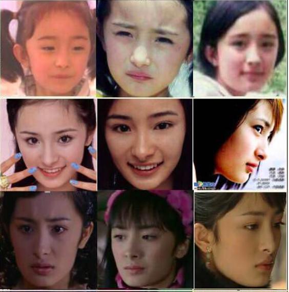 杨幂这些整容后遗症告诉你，不断返厂重修，代价得不偿失