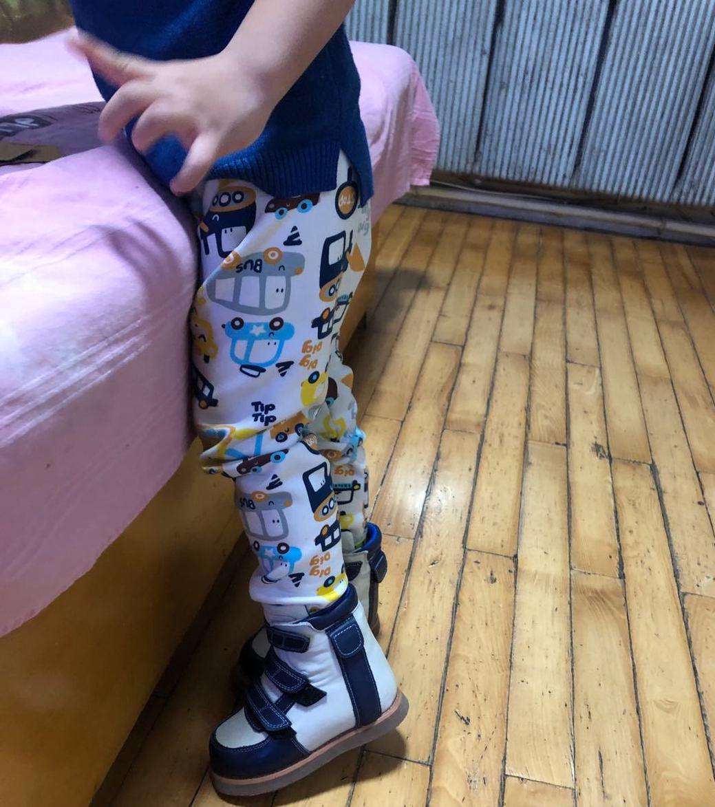 孩子足外翻买什么鞋矫正,儿童足外翻矫正鞋去哪里做