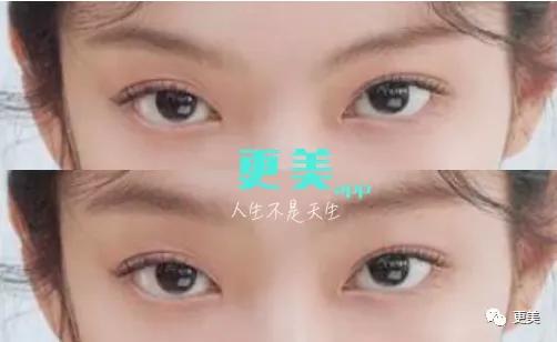 超越钟楚曦的“do脸王者”！翻了1000张照片终于知道她多牛…