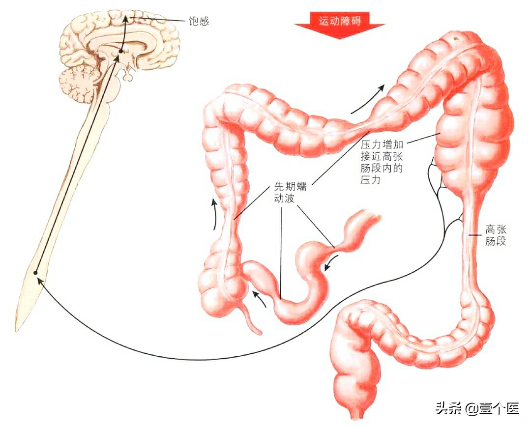 大便形成科普,大便呈球状是怎么回事?