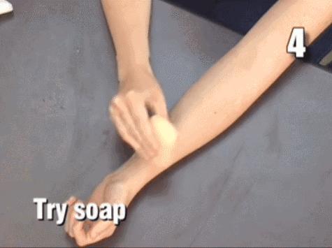 被蚊子咬了可以涂丁酸氢化可的松,被蚊子咬了但什么都没带