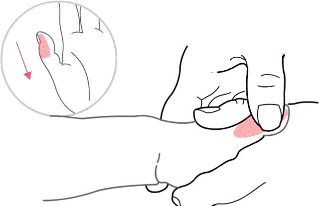 宝宝咳嗽快速止咳小妙招7-8岁,一个月的幼儿咳嗽快速止咳小妙招