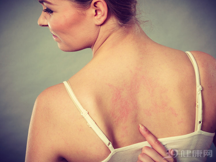 辟谣丨变态反应科到底是看啥病的？专家解密过敏的5大认知误区