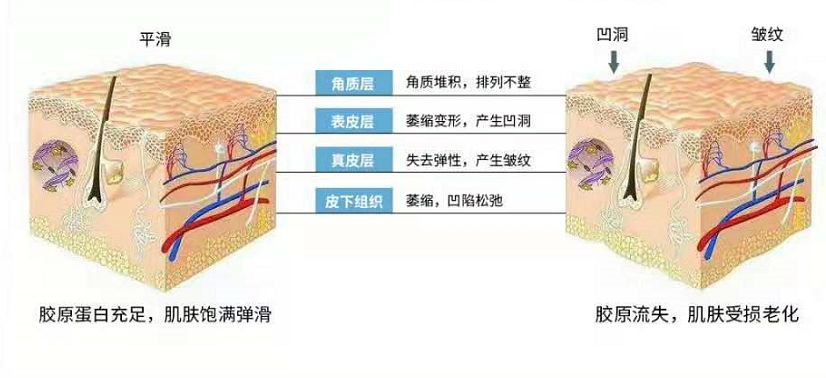 胶原蛋白流失严重怎么补胶原蛋白,胶原蛋白喝到体内能补胶原蛋白吗