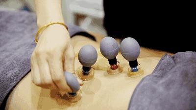 邓莎被烧伤原因,邓莎拔火罐被烧伤视频