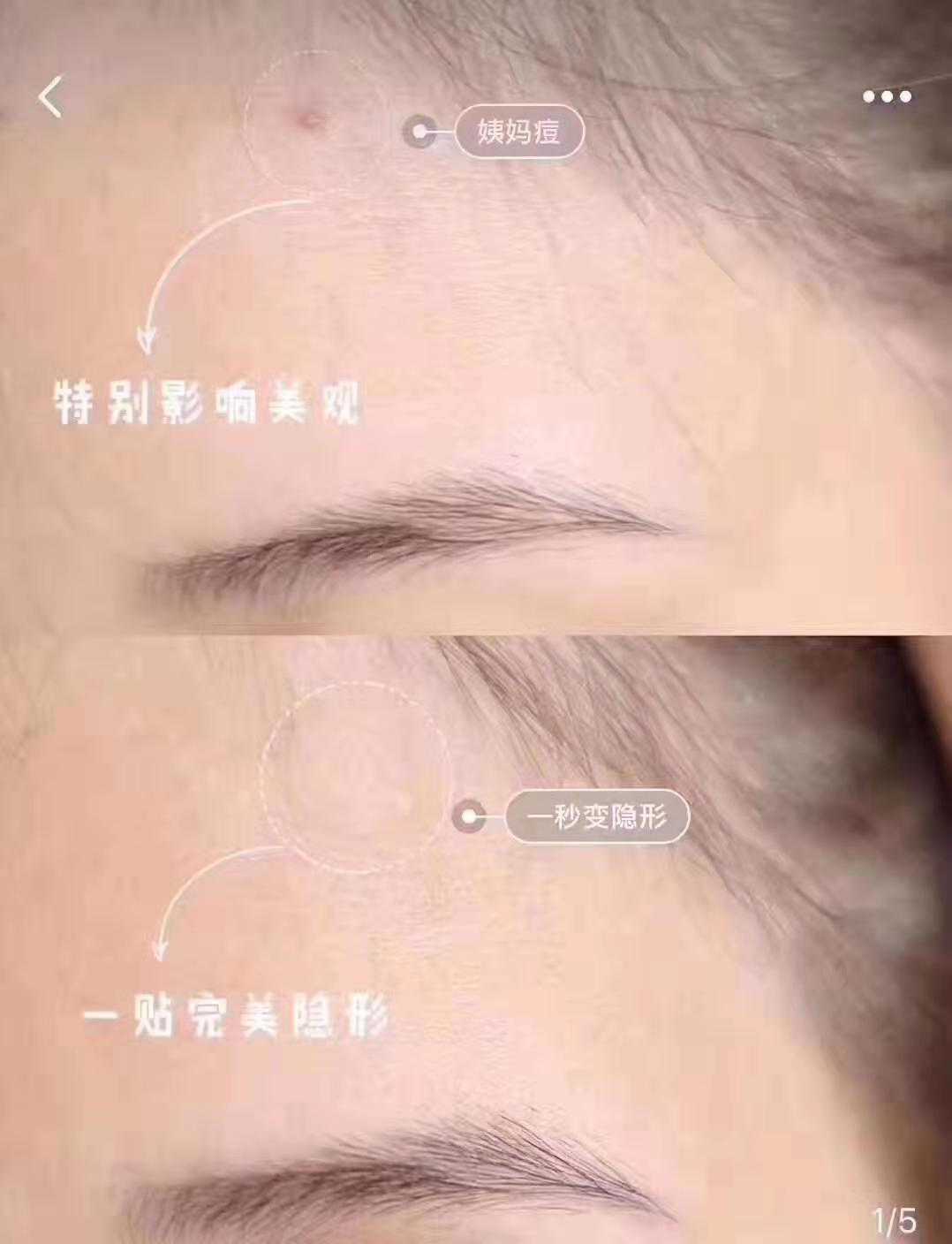 那些非常实用的护肤小东西你都知道吗？