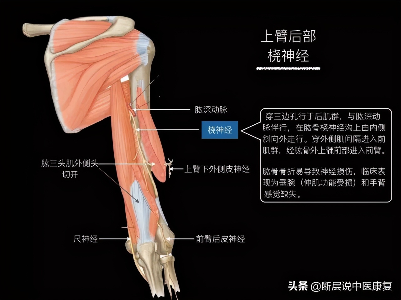 手臂人体解剖图讲解,手臂上举3d肌肉解剖讲解