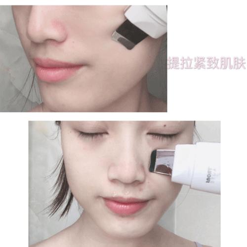 拒绝黑头、毛周角化，每天2块钱轻松搞定💖