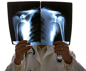 放射揭秘,放射治疗科普十问