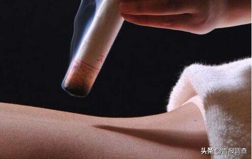 艾灸，你真的“灸”对了吗？