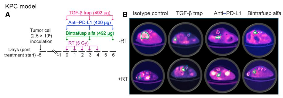 放疗brt,放疗后pd-1防复发