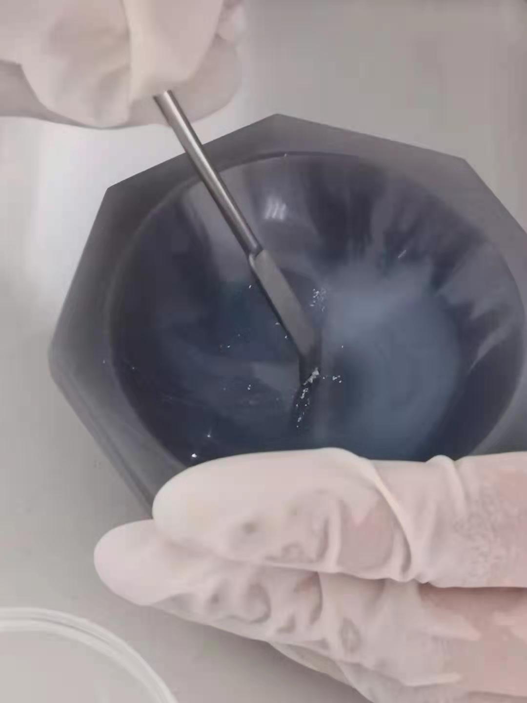 结石成分分析哪里可以做,结石分析成分要挂什么科