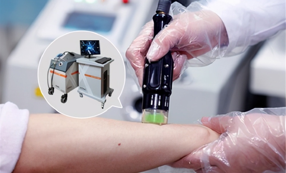 治疗白癜风到底是激光治疗好还是手术治疗好？