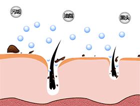 用手挤黑头小心变成草莓鼻，每天用这两样东西搓，黑头很快消失