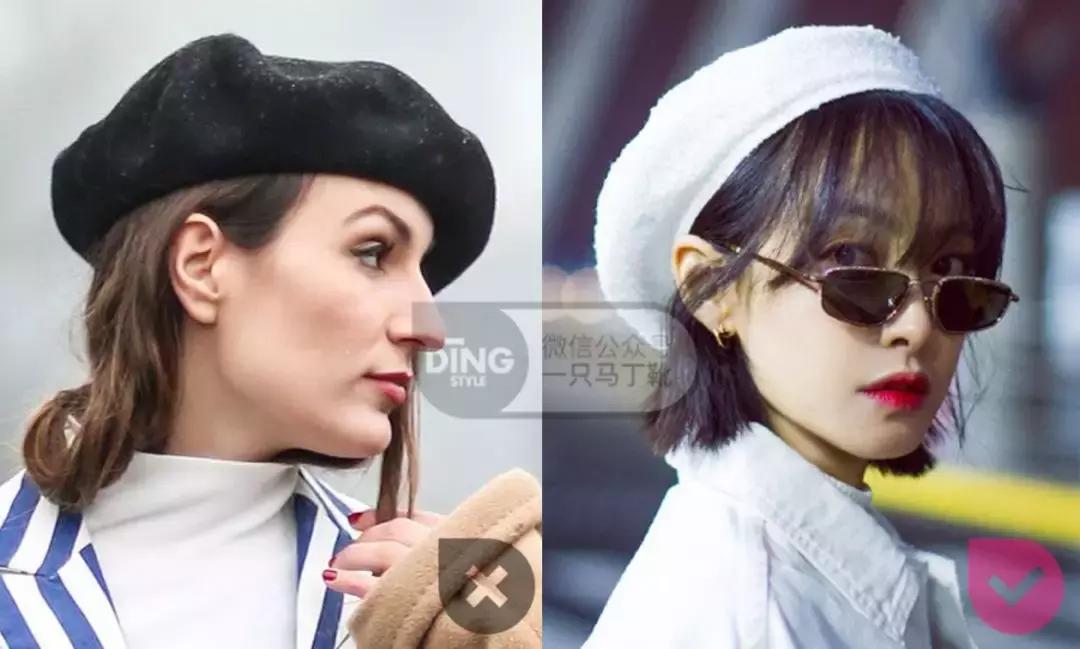 扁头有什么办法改善头型吗,扁头怎么让头变得饱满些