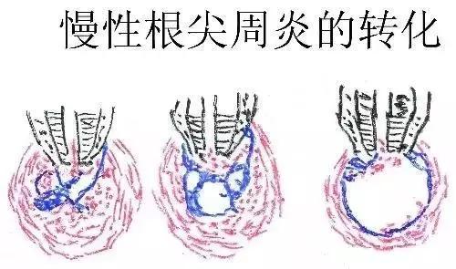 牙齿痛怎么办教你一招搞定牙痛,牙痛怎么样判断牙齿什么问题