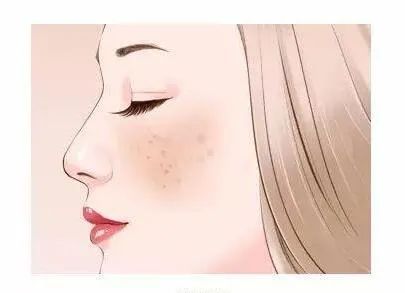 脸部长斑是什么原因,脸部长斑是什么原因导致的