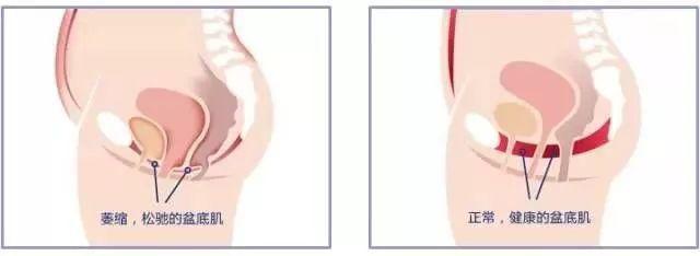 产后康复比生孩子还贵,产后康复和成人康复哪个前景好