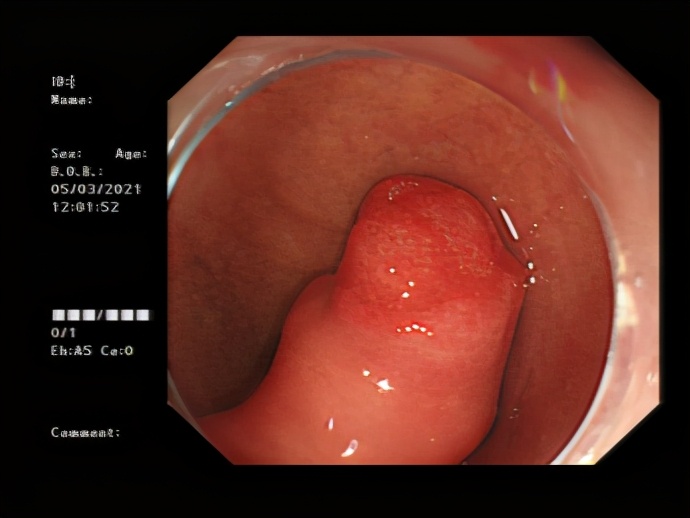 胃经常不舒服有时候还恶心,胃经常不舒服也不疼