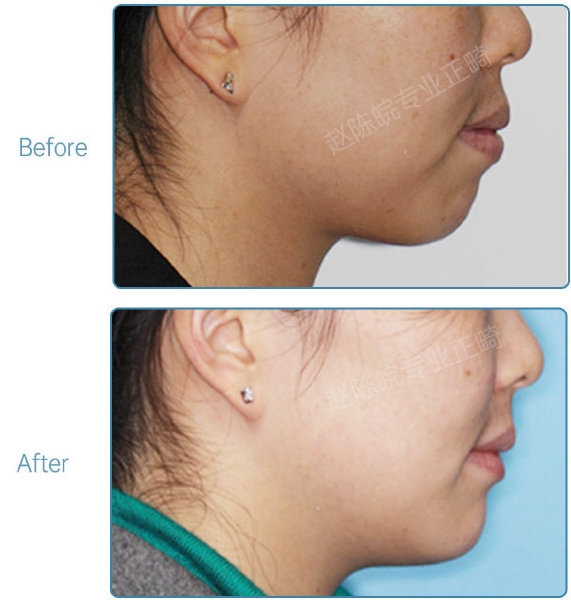 杭州口腔医院整牙,杭州整牙医生怎么选