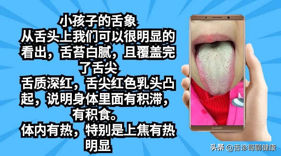 舌诊歌舌象分析与感悟,舌诊哥聊健康痰湿