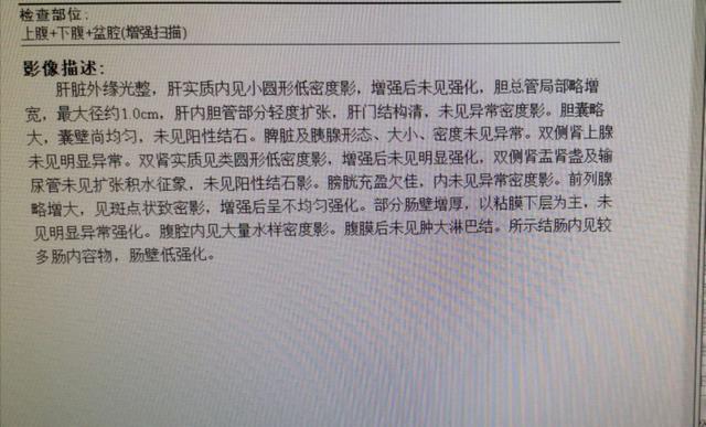 中西医结合治疗原因不明肠梗阻、腹水转氨酶明显升高病案一例！