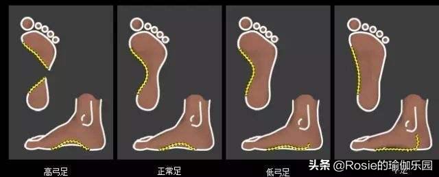 女生怎么练改善斜方肌,斜方肌练大了