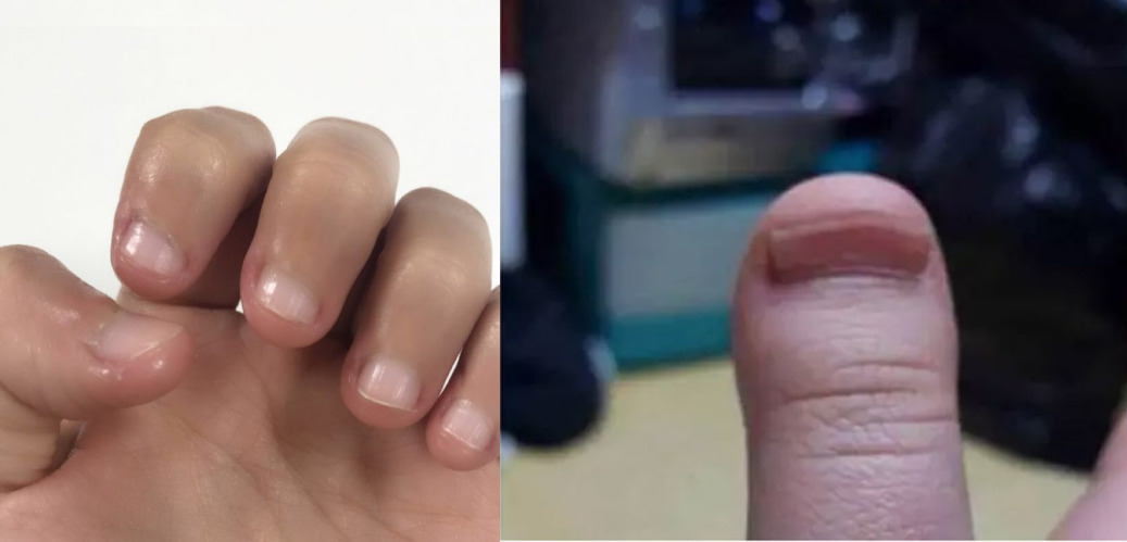 易劈易断还分层？美国专业沙龙修复甲油，给“病甲”快速“整容”