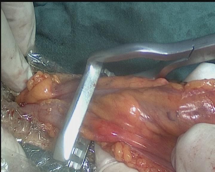 娓崡甯傜浜屽尰闄㈣偪鐦よ兏澶栫,鑲跨槫鍖婚櫌鑳镐簩澶栫