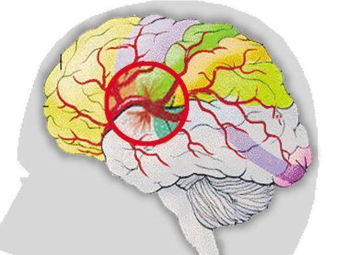 为什么肥胖患者麻醉苏醒延迟,麻醉延迟苏醒怎么办