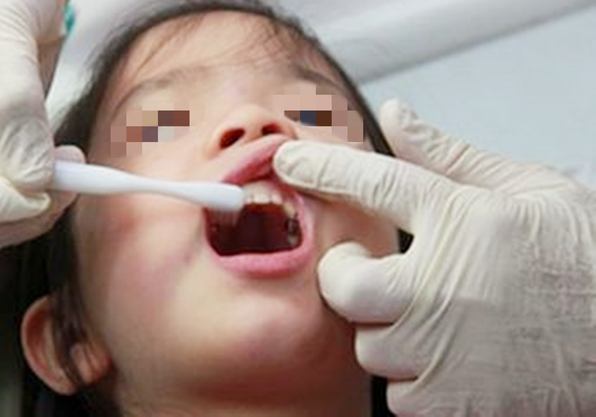 2岁多宝宝咬502胶水,宝宝把502胶水弄到口腔里怎么办