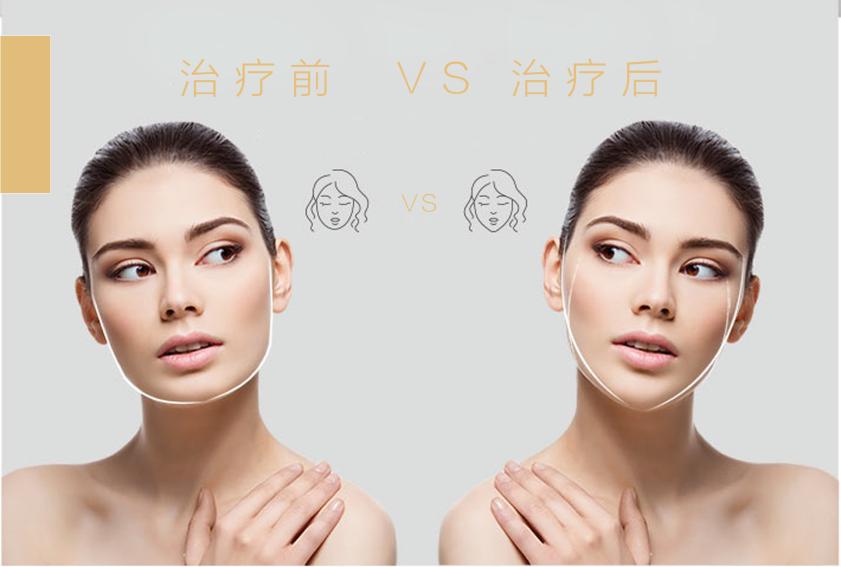 娃娃脸婴儿肥怎么瘦,怎么区分双下巴和婴儿肥