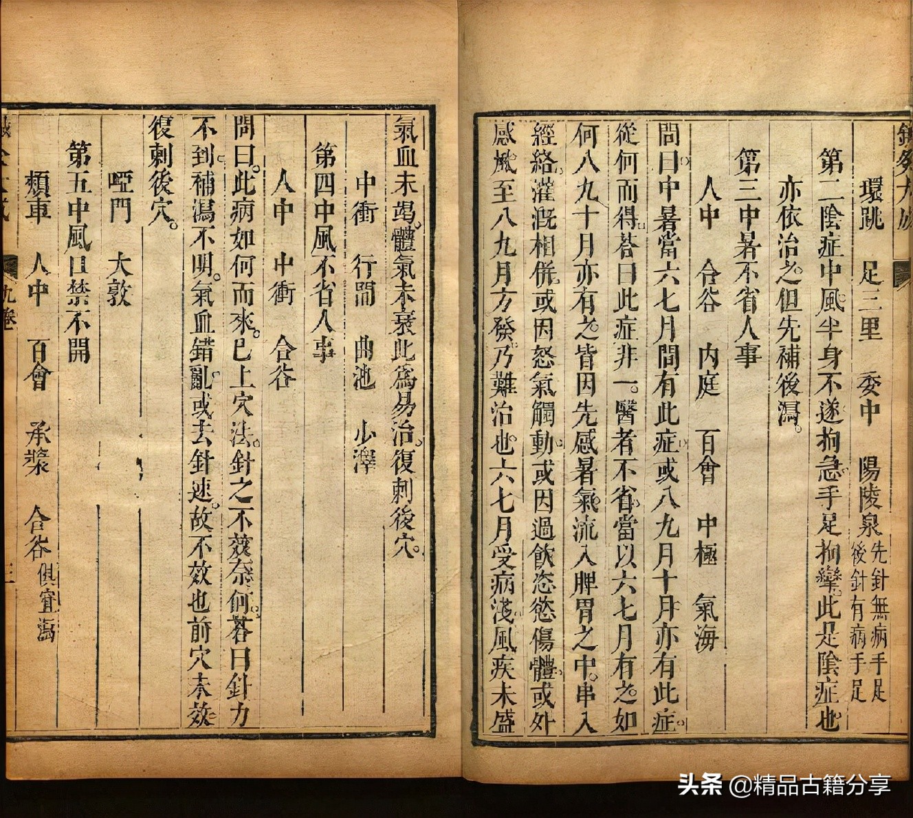 针灸书排行榜前十名,针灸全书阅读