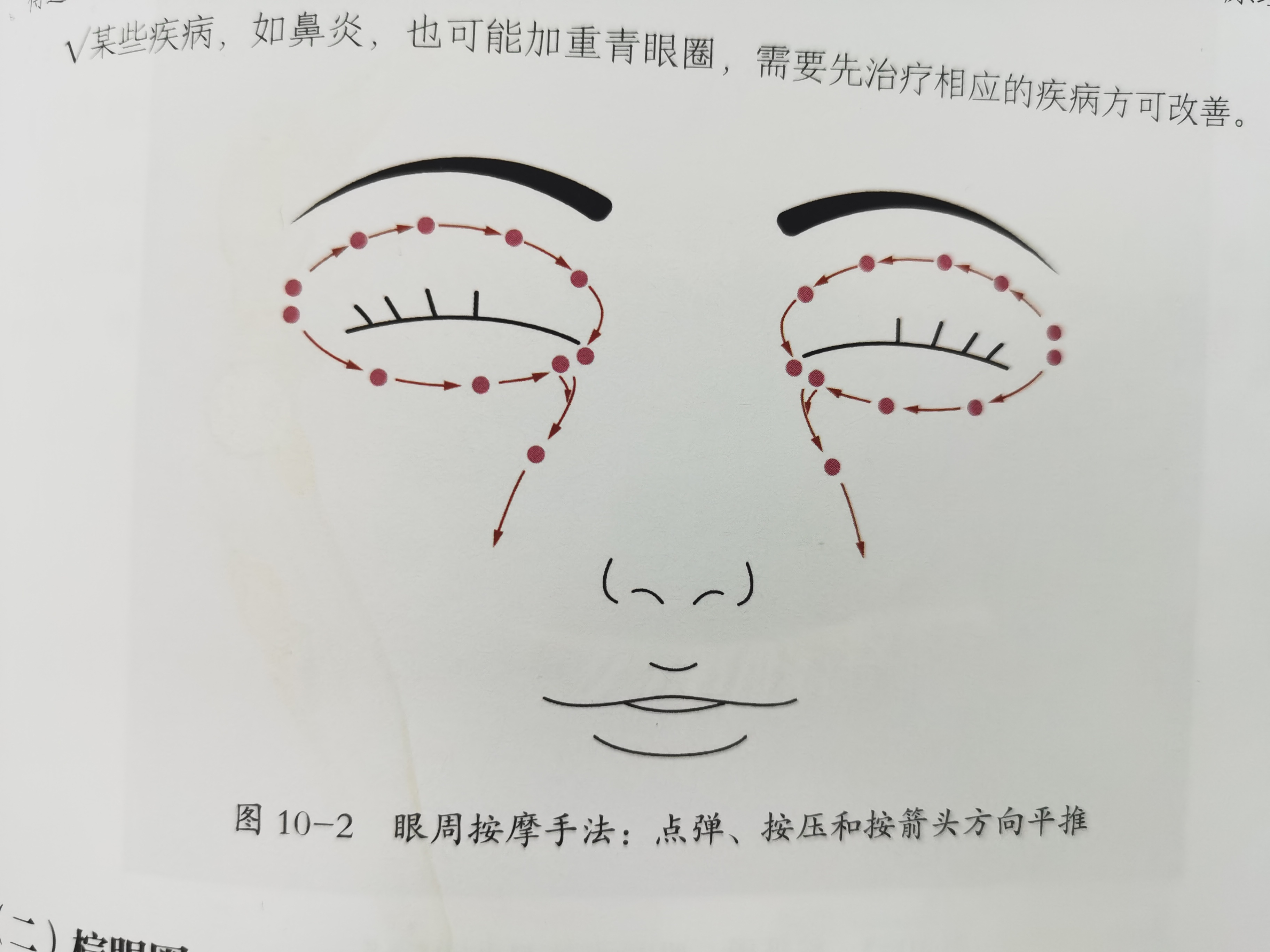 黑眼圈严重怎么办才能彻底去除,黑眼圈严重怎么办快速去除