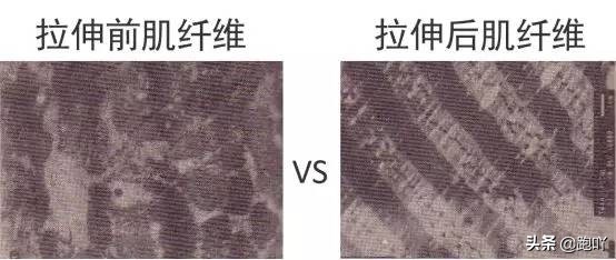 排酸跑和恢复跑有什么区别,马拉松赛后怎样尽快恢复腿痛