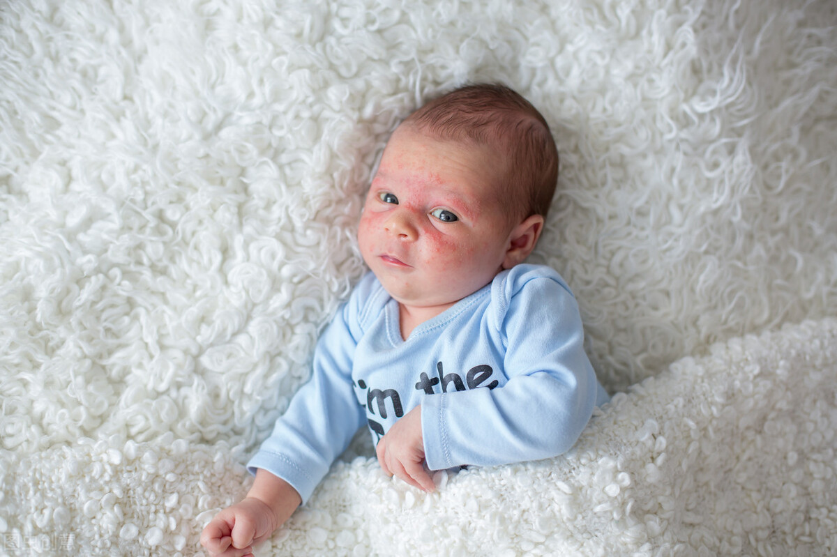 新生儿湿疹反复发作的原因是什么,宝宝湿疹反复发作怎么办