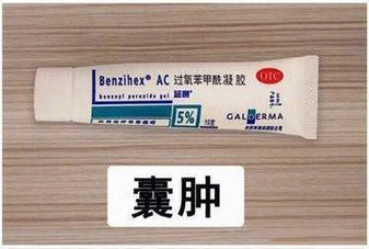 痘坑黑头药膏,祛黑头痘痘闭口疤痕的药膏