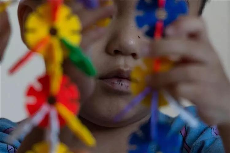 嘴唇黑斑是黑斑息肉综合症吗,黑斑息肉病建议要孩子吗