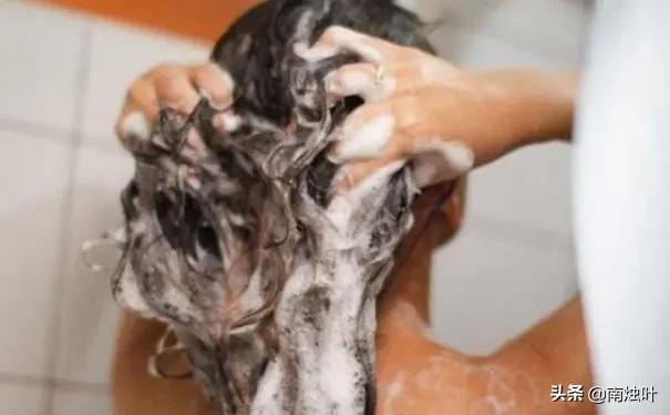 头皮出油的最佳解决方案,头皮易出油头发贴头皮怎么解决